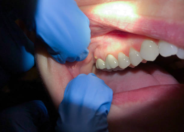 Best 24-Hour Dental Clinic Near Me  in Mcadenville, NC